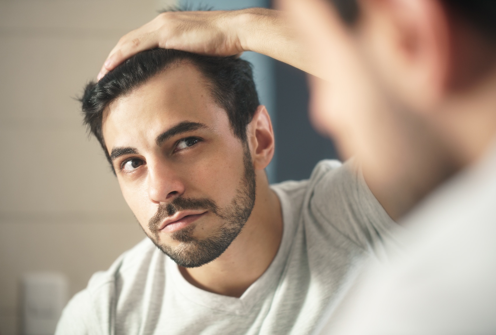 What causes Male Baldness?