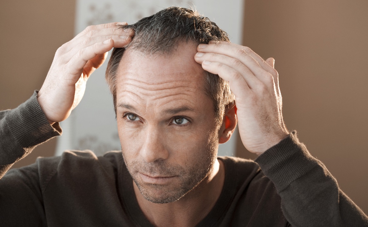 Queda de Cabelo Masculino