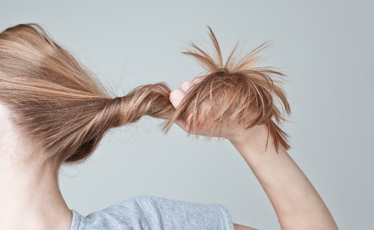 Tricotilomania: uma necessidade irreprimível de arrancar cabelos